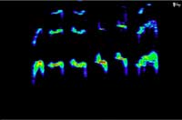 postop spectrogram