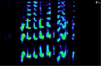 preop spectrogram