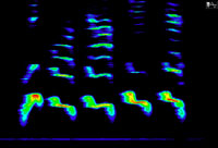 spectrogram 16 weeks post op