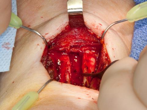 Central opening of the larynx