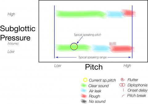 Vocal signature of a nodule