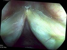 verrucous keratosis lesion 6 months after excision