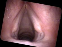 the final granuloma has fallen off and the area where the end tracheal tube was has healed